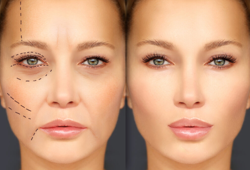 the-10-most-common-plastic-surgery-procedures