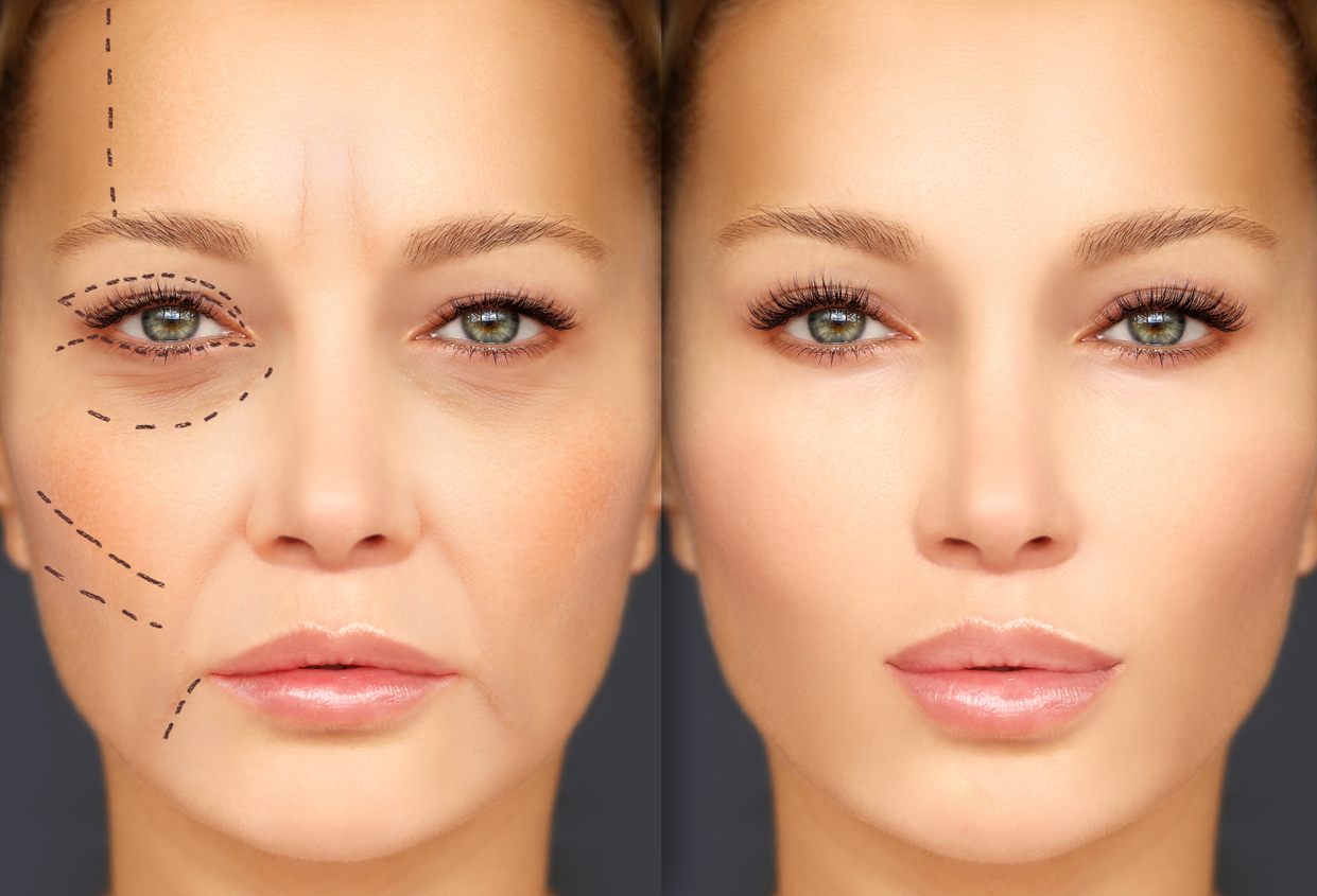 The 10 Most Common Plastic Surgery Procedures