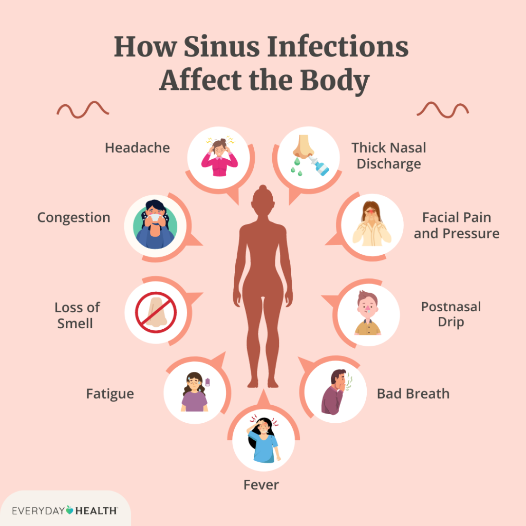 Are Sinus Infections Contagious